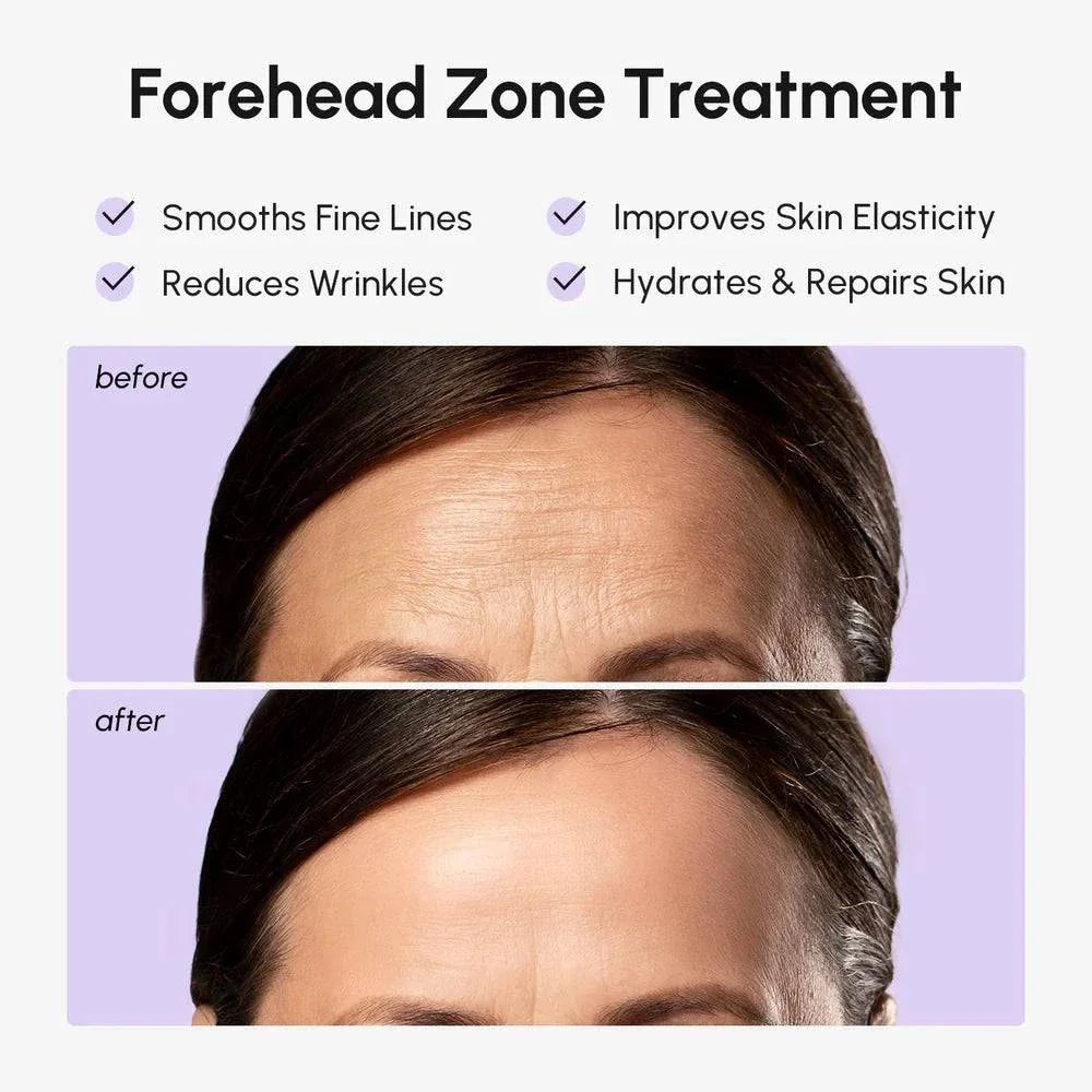 Anti-Wrinkle Forehead Patches treatment graphic showing before-and-after forehead comparisons and claims about smoothing fine lines and hydrating skin