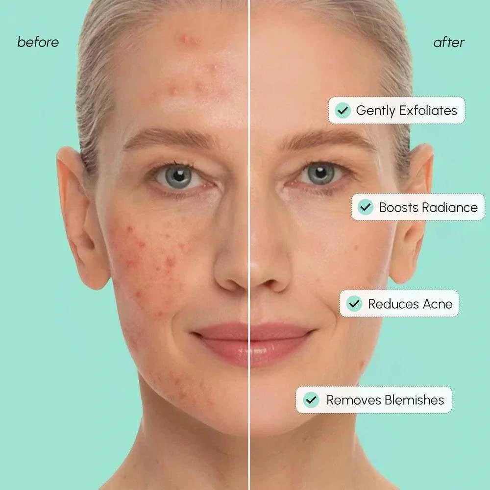 Marée Azelaic Acid toner pads soothing redness and blemishes