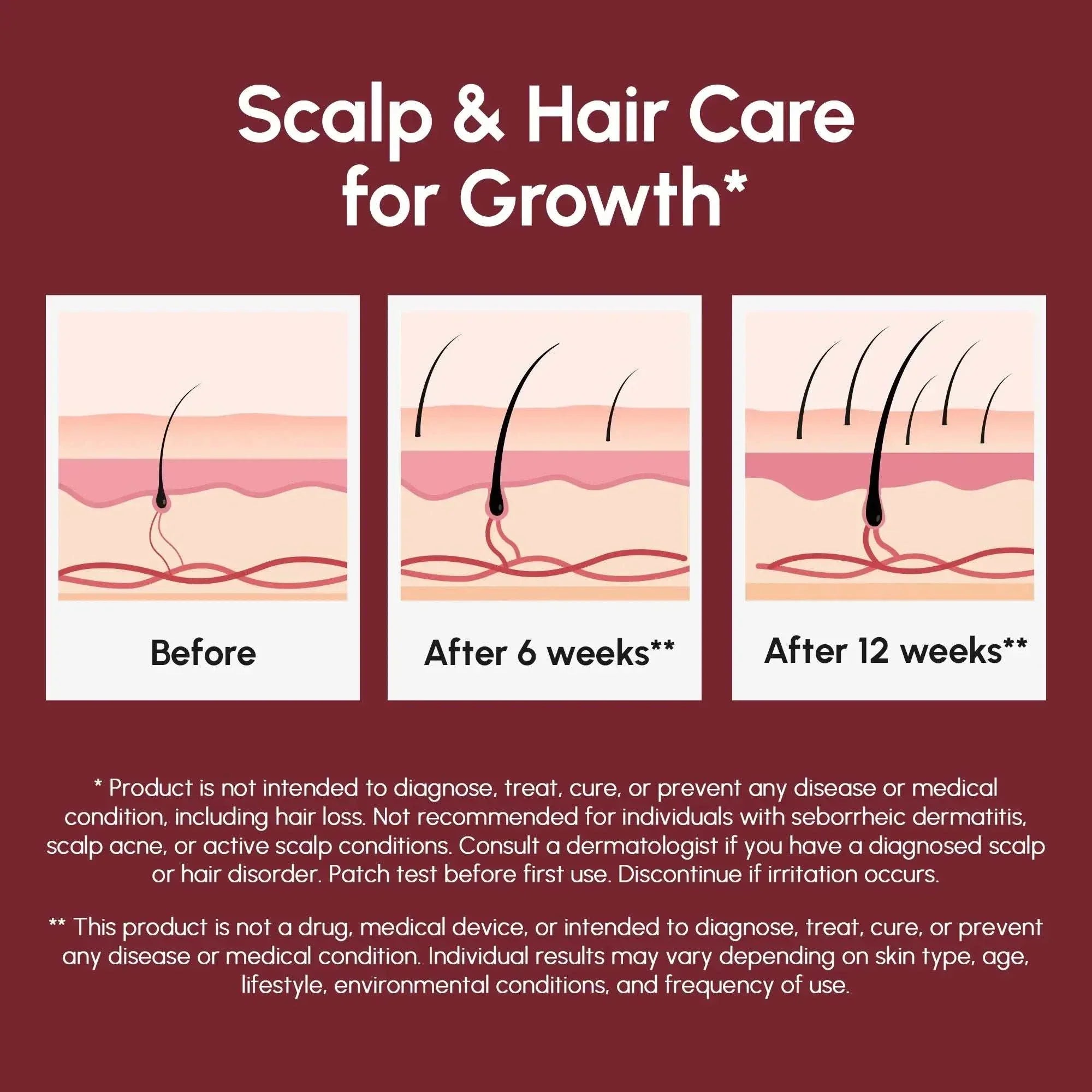 Batana Hair Growth Mask appears in a scalp growth infographic with pink skin layers and hair follicles shown before, after six weeks and after twelve weeks.