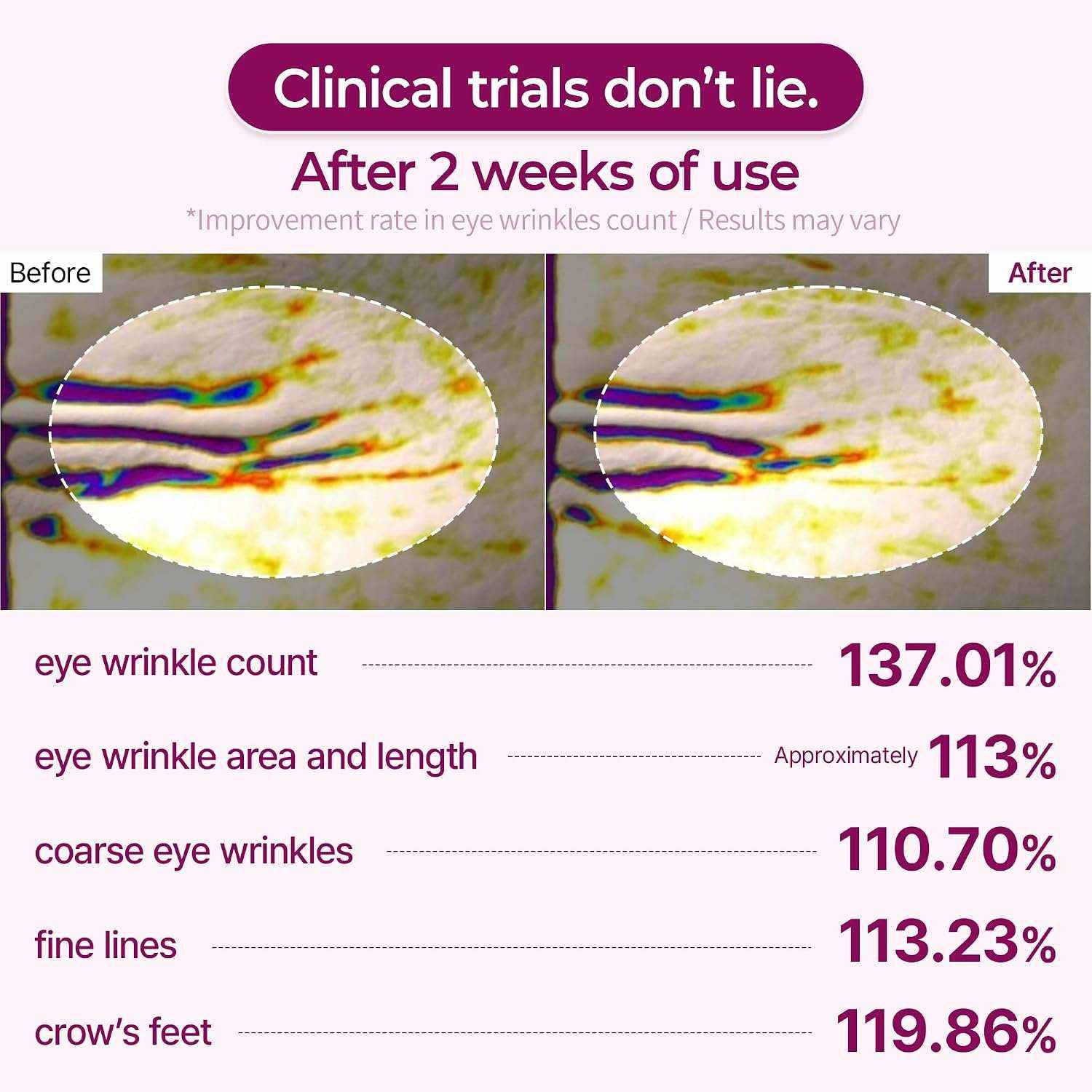 Calcium volume patch eye treatment showing before and after results with significant improvement in eye wrinkles and fine lines