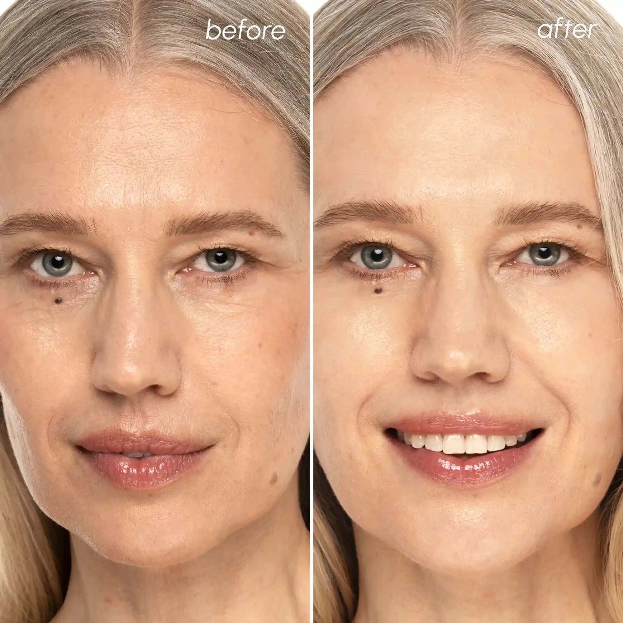 Collagen and retinol toner pads for anti-aging skincare