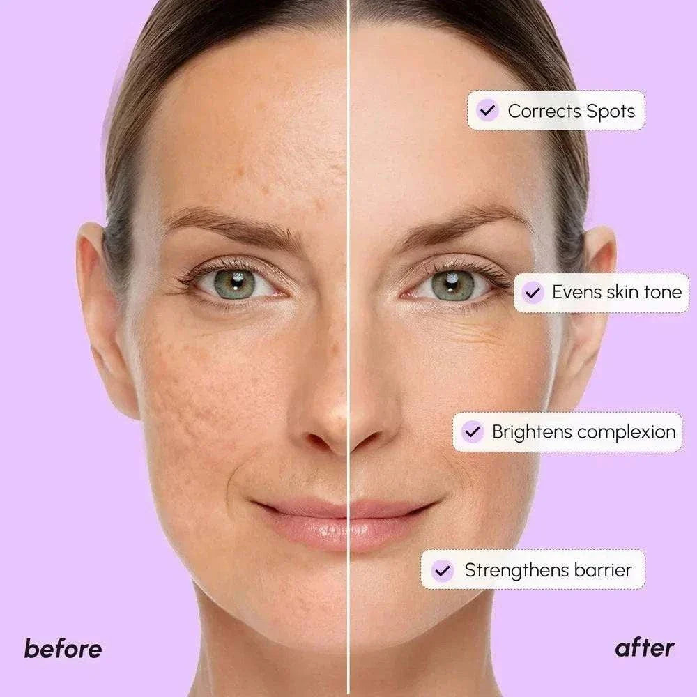 Marée Tranexamic acid dark spot corrector serum for radiant skin
