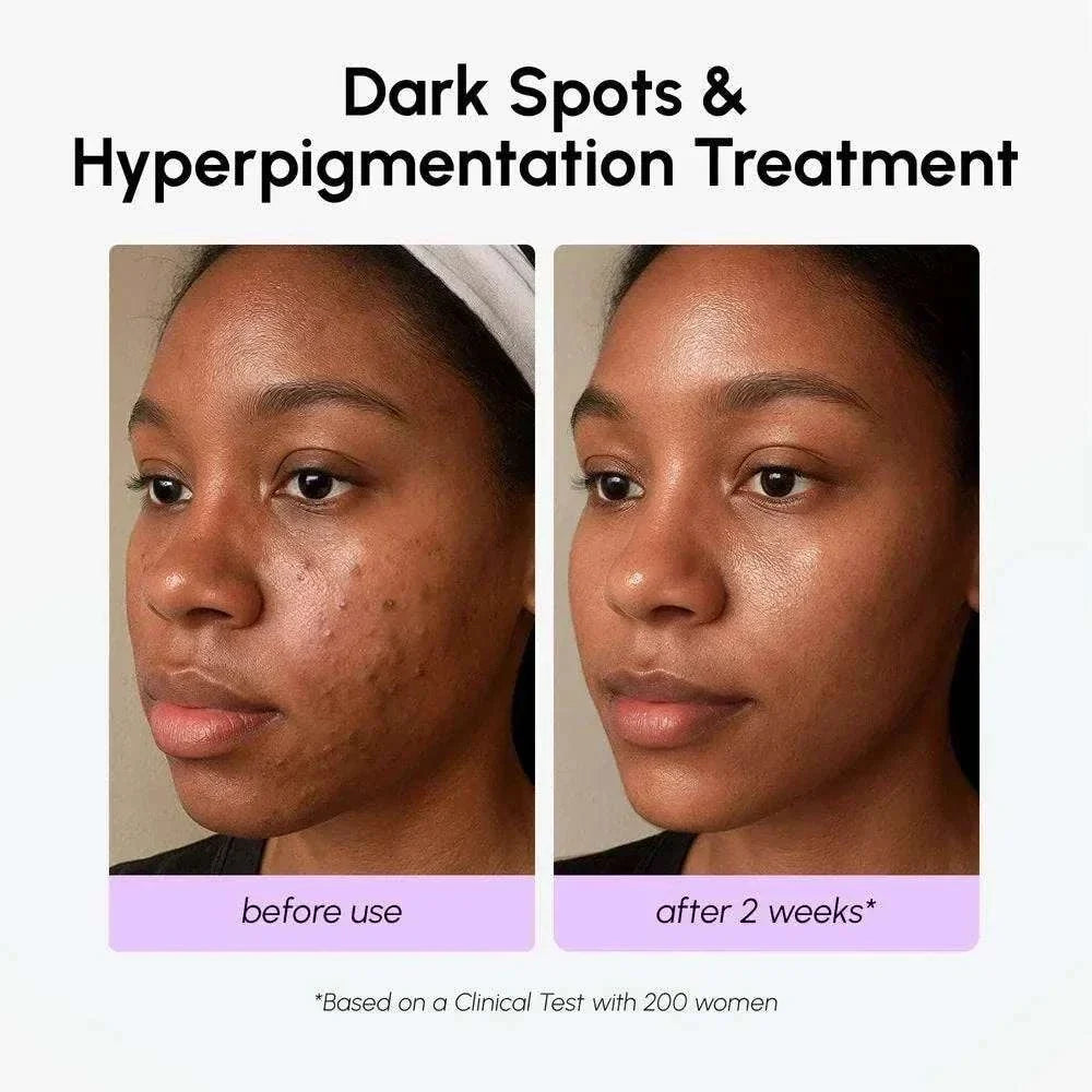 Marée Tranexamic acid dark spot corrector serum for radiant skin