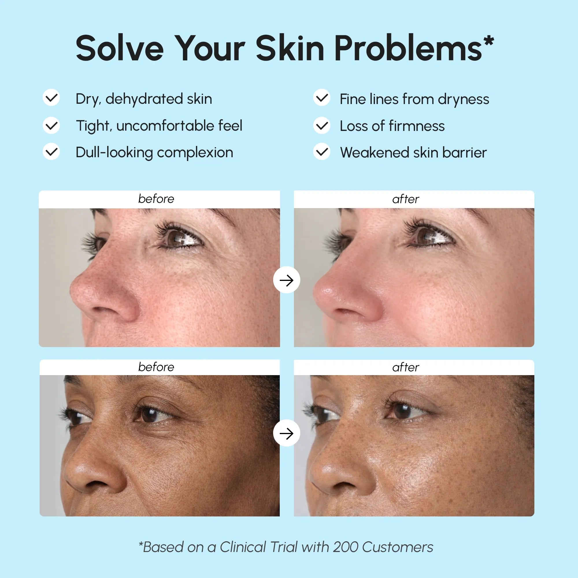 Deep Moisture Collagen face cream benefits graphic with two before-and-after skin comparisons and claims about dryness, fine lines, and firmness