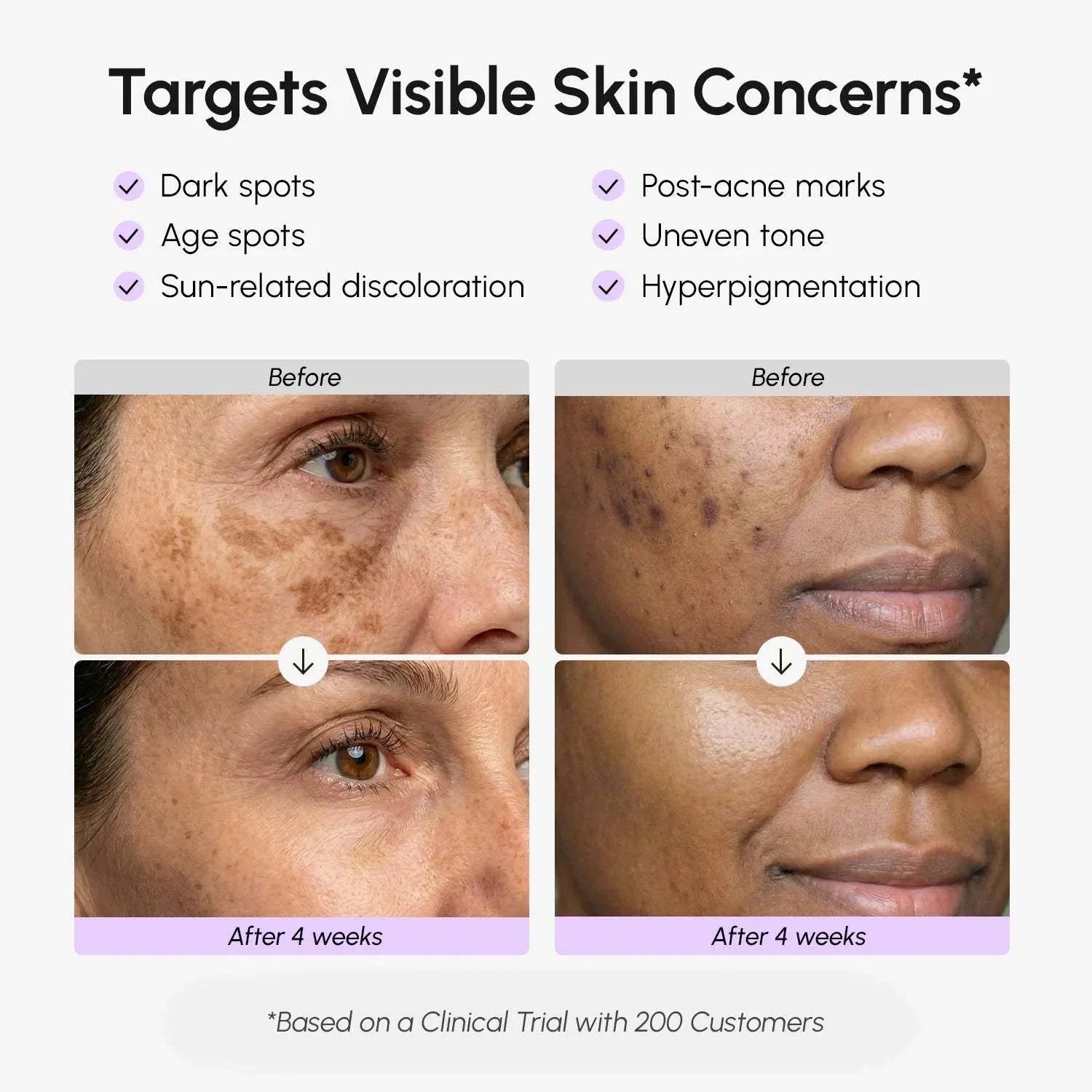Face & Body Serum results graphic showing skin before and after four weeks, with dark spots and post-acne marks visibly reduced