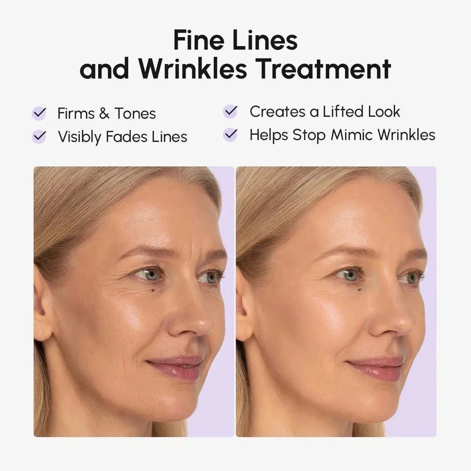 Marée face lift tape wrinkle patches smoothing facial wrinkles