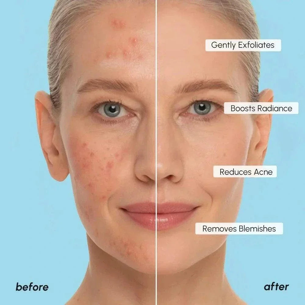 Glycolic acid face toner pads with exfoliating and hydrating ingredients