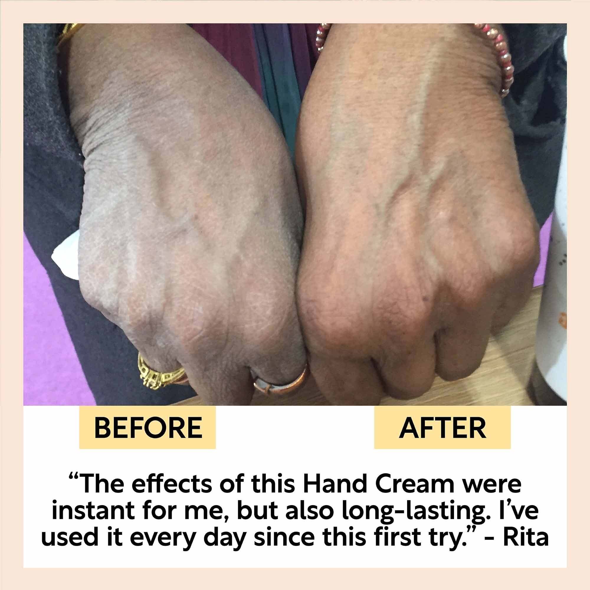 Hand Cream with Hibiscus Flowers shown in a before-and-after comparison, visibly improving dry, wrinkled hands