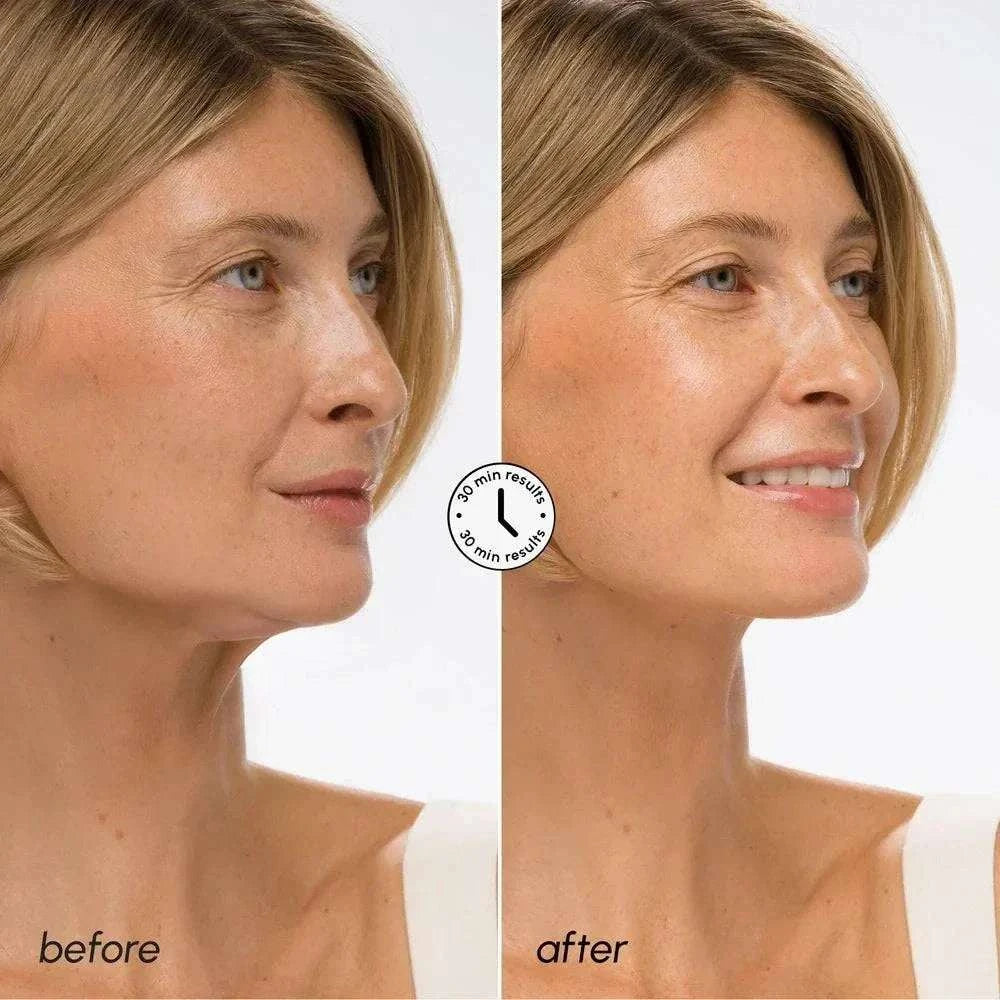 Hyaluronic Acid V-line Lifting Mask for firm jawline and smooth neck