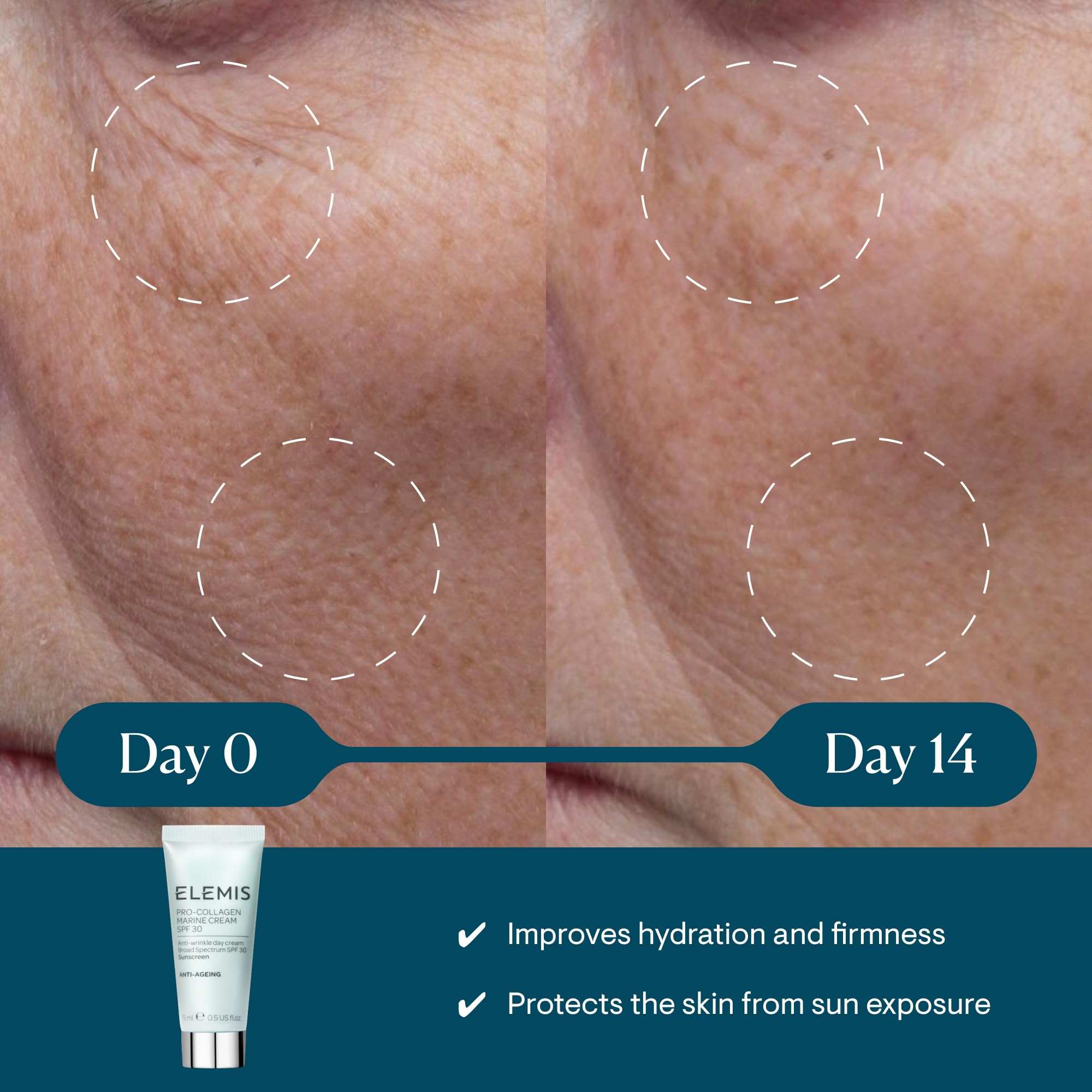 Lightweight anti-wrinkle daily facial moisturizer shown with Day 0 and Day 14 skin comparison, SPF 30 benefits