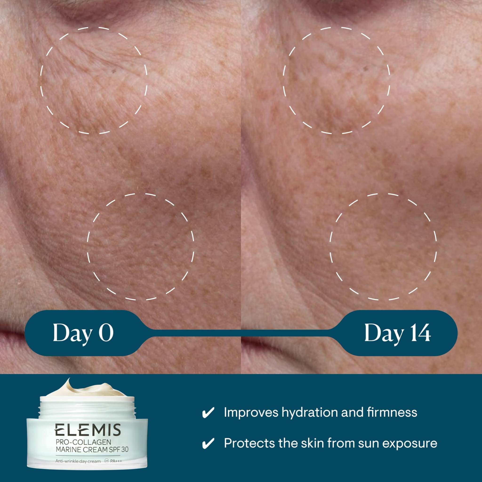 Lightweight anti-wrinkle daily facial moisturizer shown with ELEMIS cream jar and Day 0 to Day 14 skin comparison
