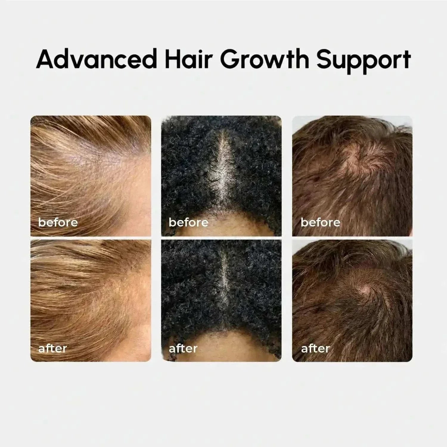Marée 4-in-1 hair growth spray bottle for scalp nourishment and fast hair growth