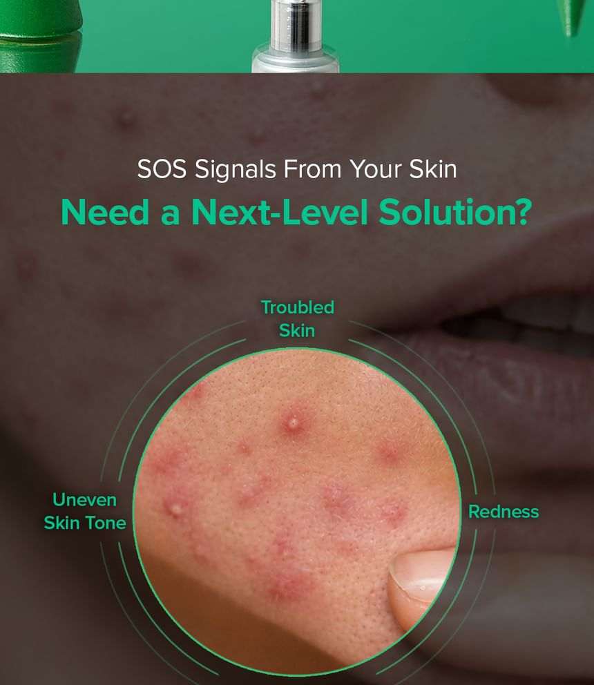 Mary & May Spicule spot cream for troubled skin, featuring a close-up of red blemishes and uneven tone