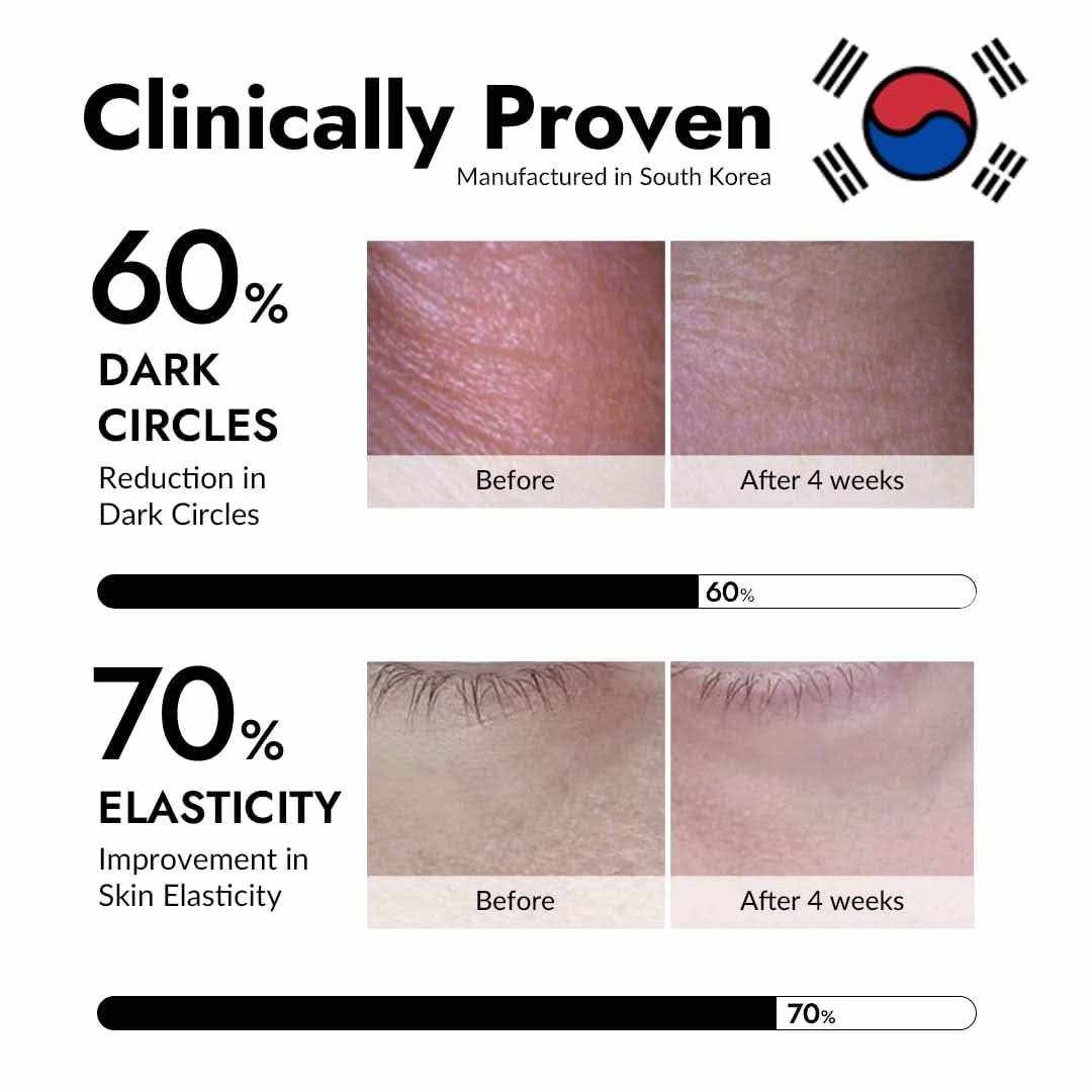 Before and after close-up photos showing skin improvement, highlighting 60% dark circles reduction and 70% elasticity increase with mizon eye patch