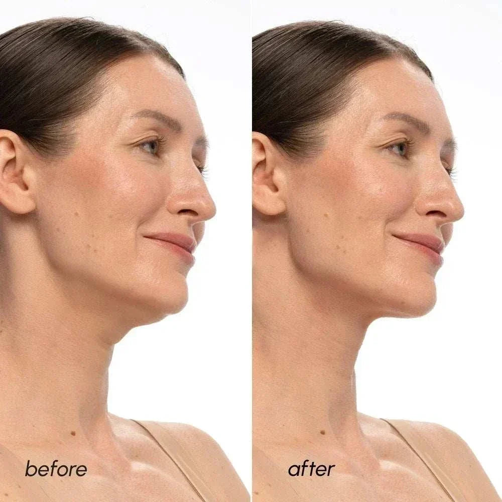 PDRN V-line Lifting Mask before and after comparison showing a woman's jawline and chin contour
