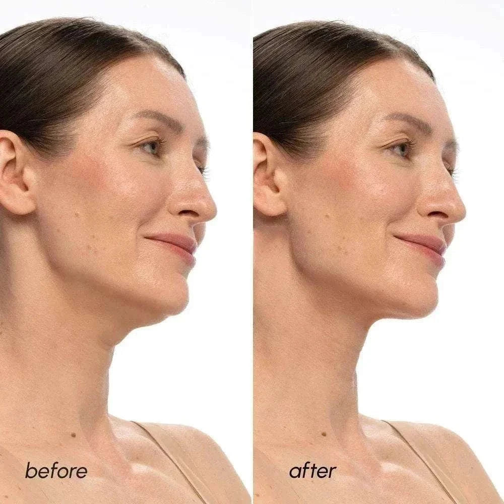 PDRN V-line Lifting Mask for youthful jawline and skin lift