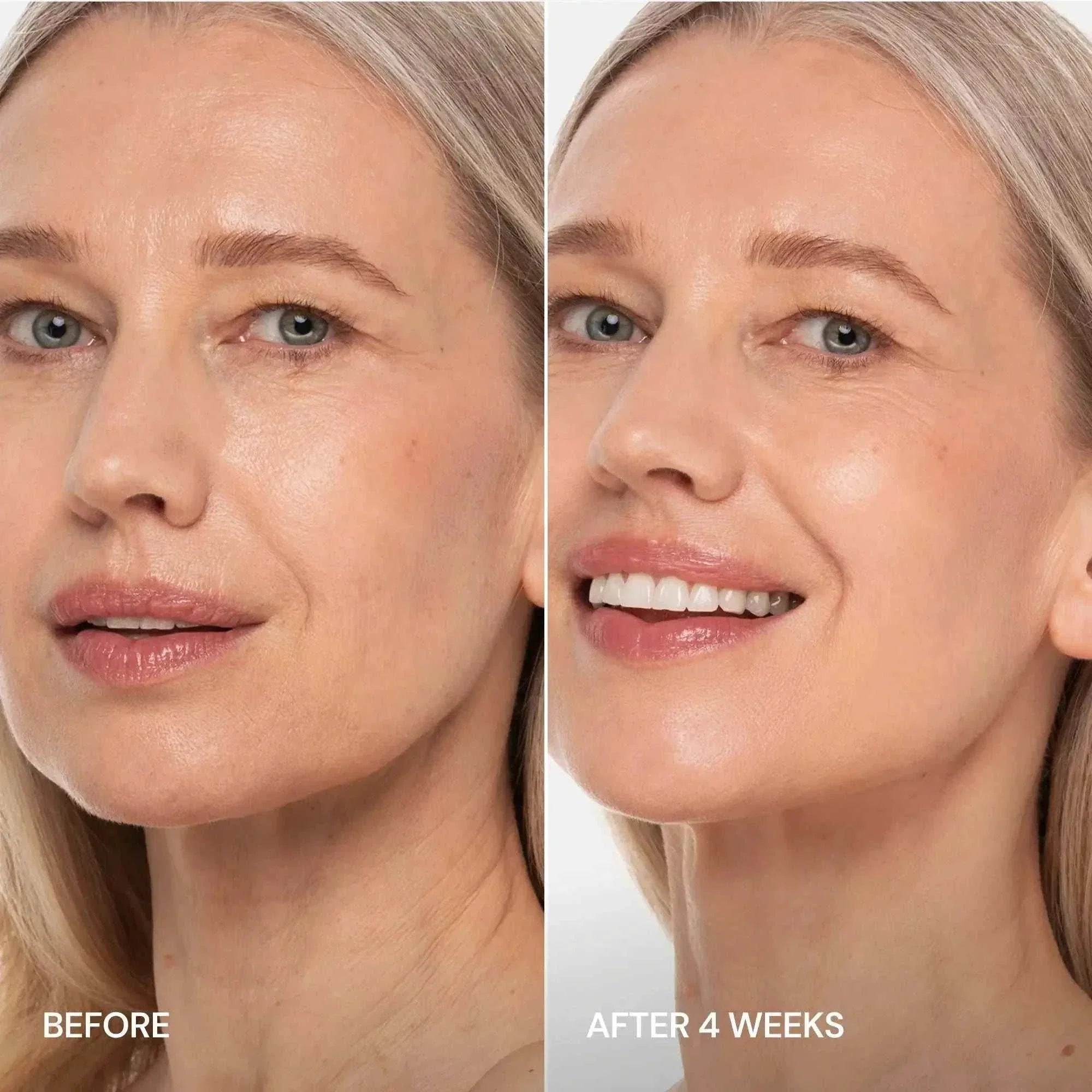 Pro-Retinol neck lifting cream with metallic massager for firming