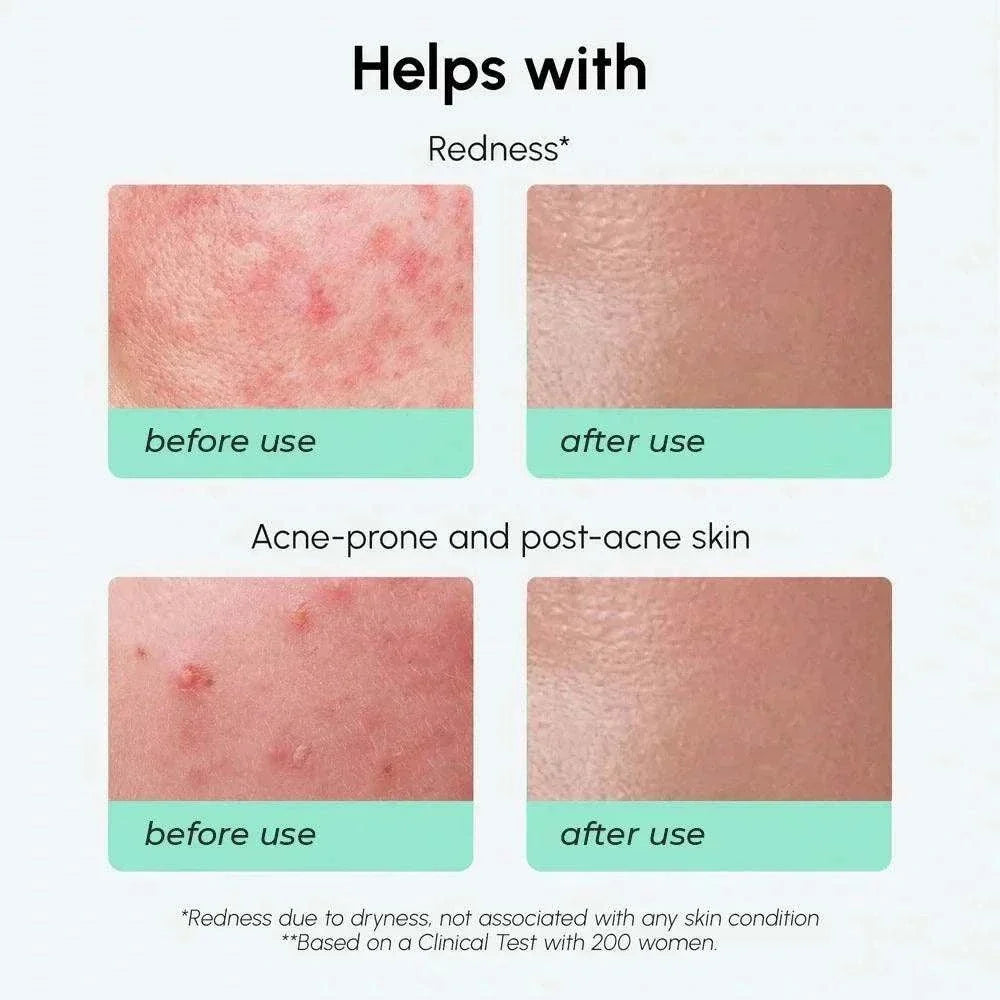 Marée redness soothing azelaic acid serum for sensitive skin
