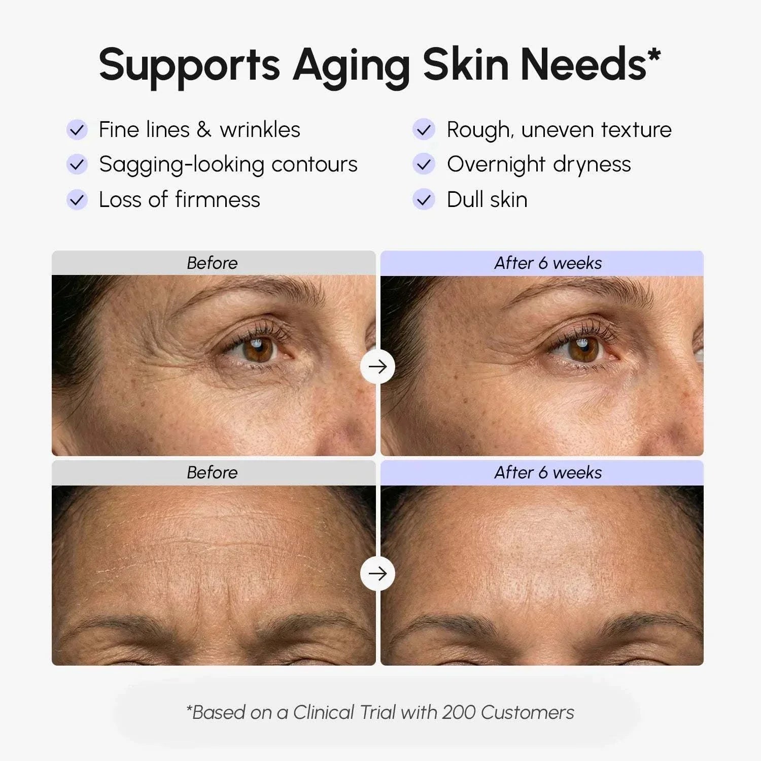 Retinol Lifting & Firming skincare results graphic showing before-and-after close-ups of eye and forehead wrinkles after six weeks