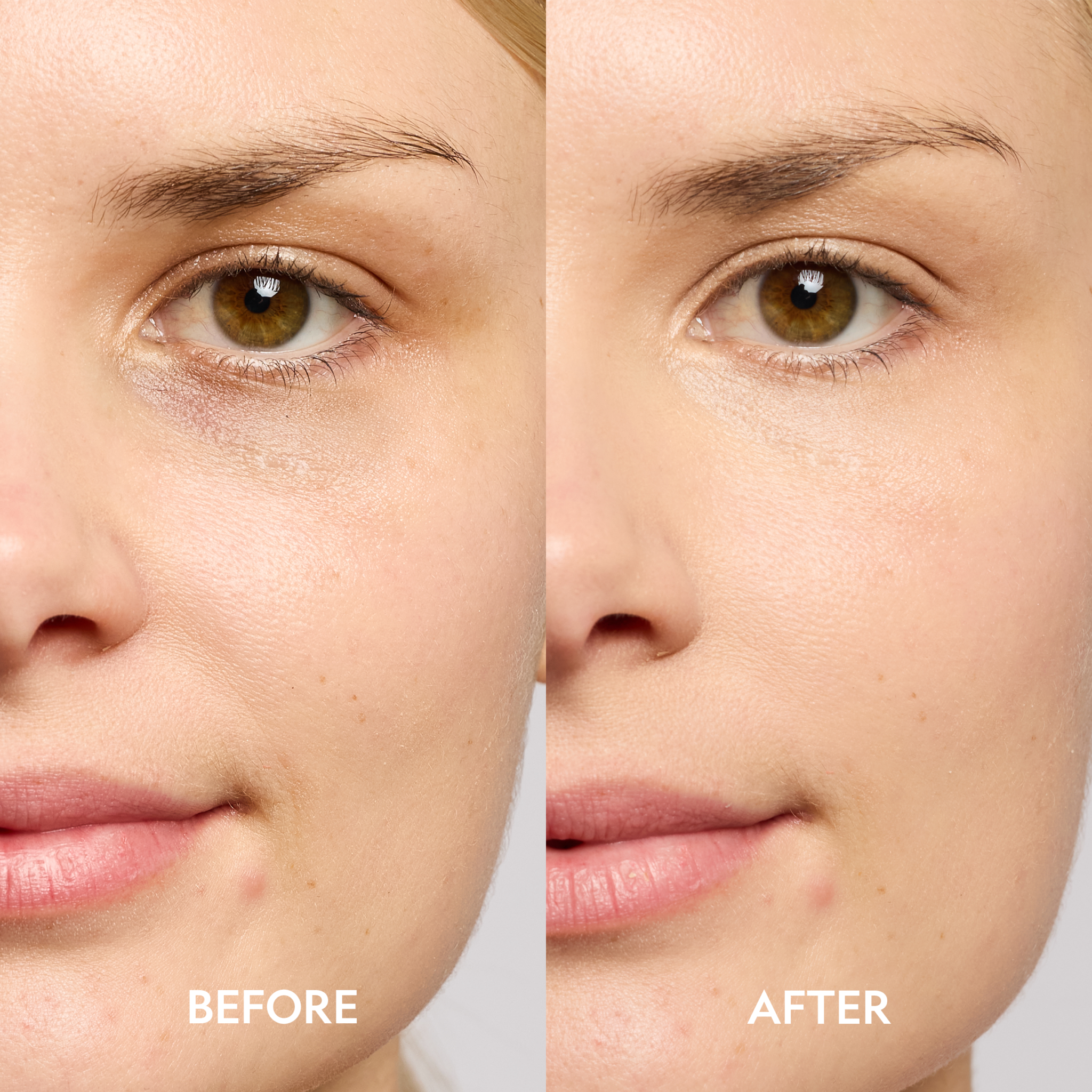 Super Bright Dark Circle Serum Peptide Corrector for under-eye brightening