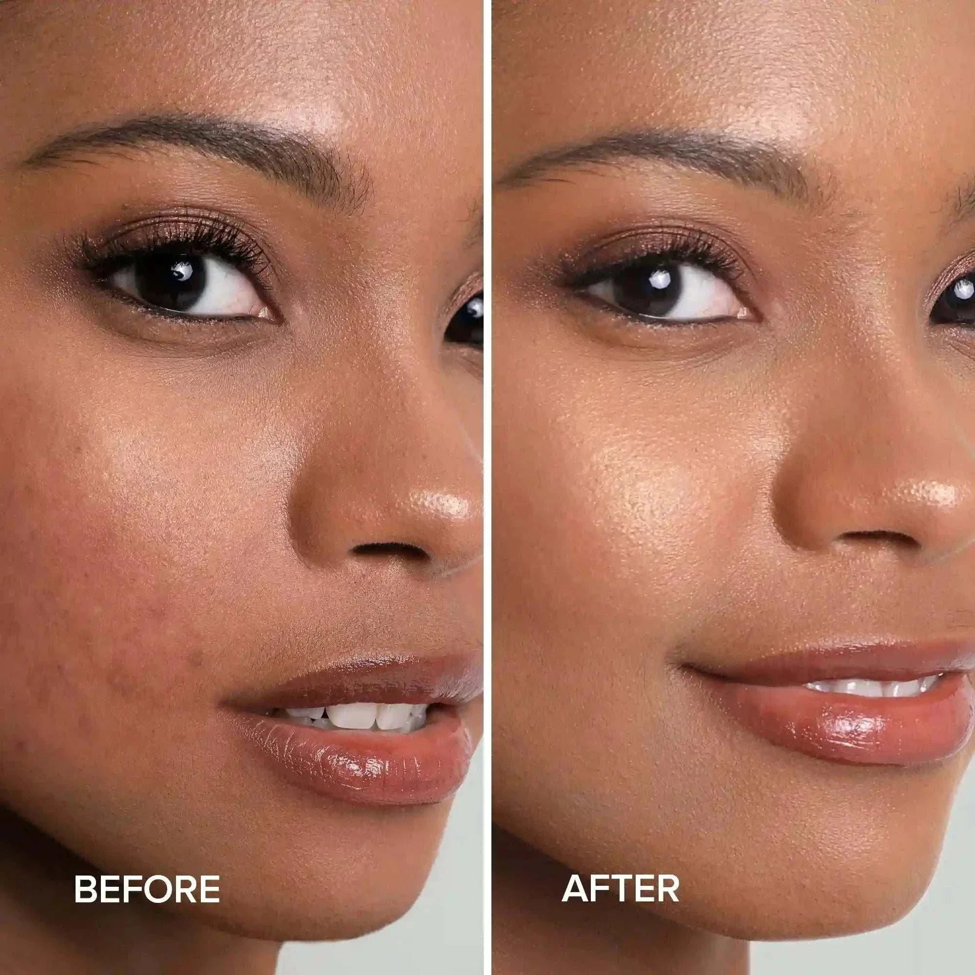 turmeric kojic acid soap and scrub for acne and hyperpigmentation