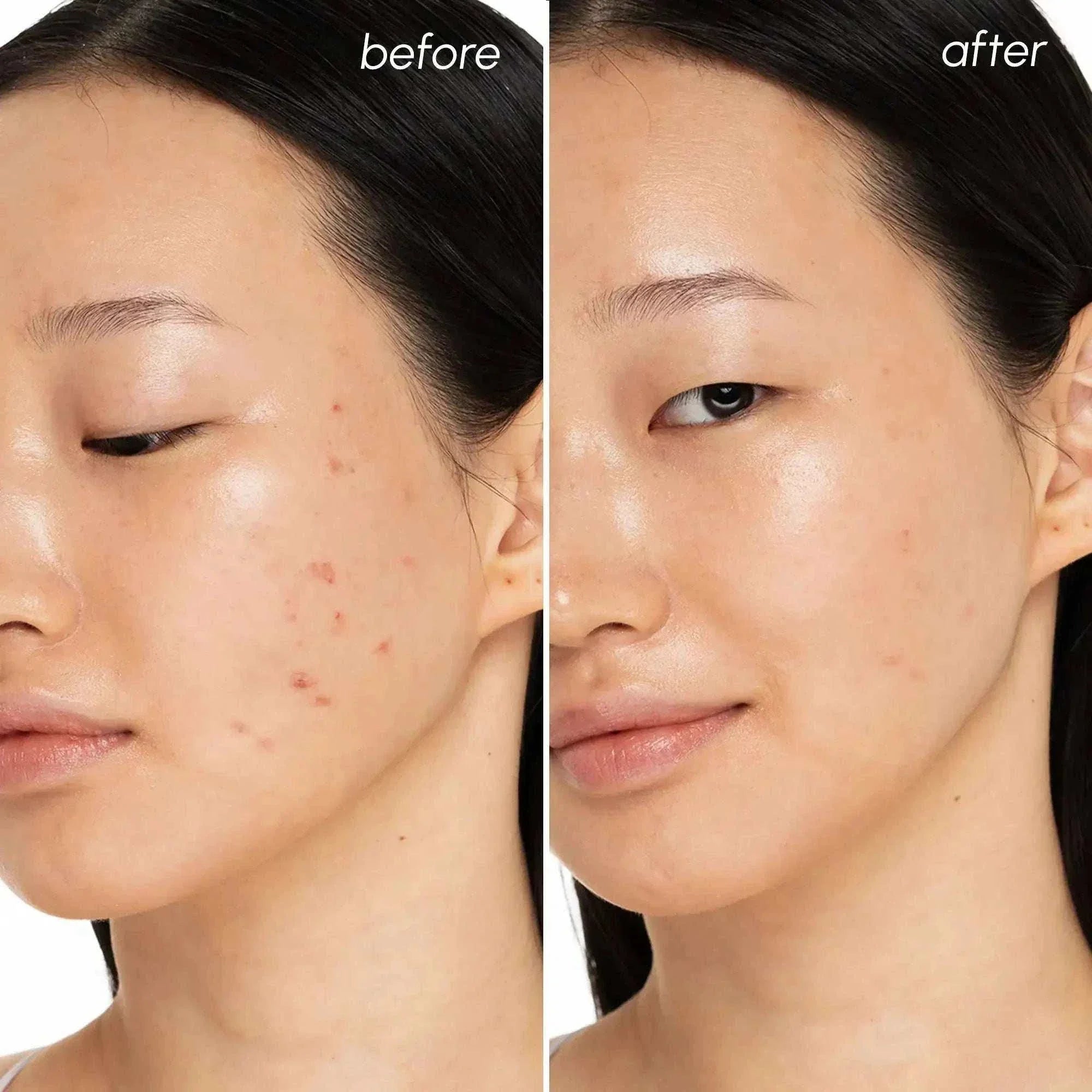 Witch hazel clearing pads for exfoliating and soothing skin